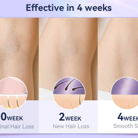 SKB 2308-Ipl Hair Removal Handset Home Use Ipl Laser Hair Removal Device